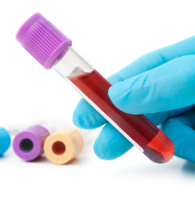 Genetic testing for Labradors